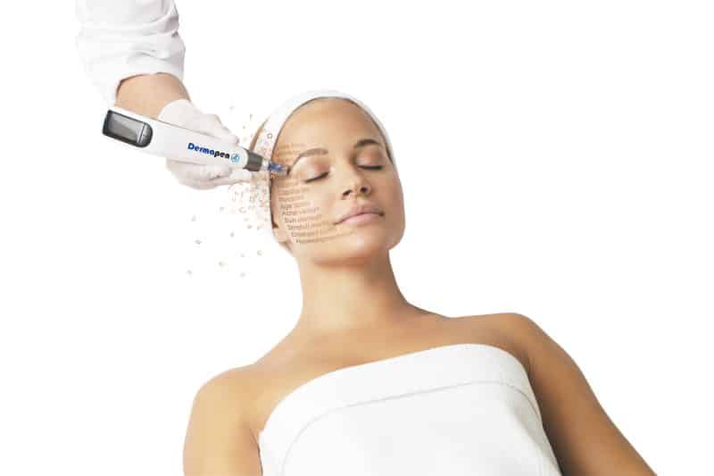 microneedling den haag